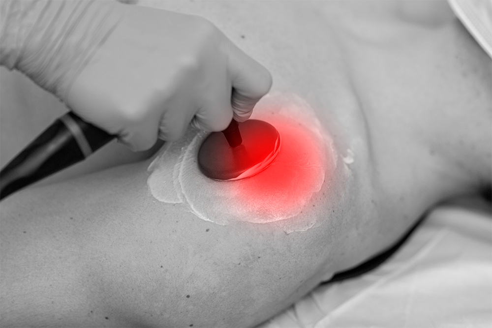 Diatermia en el Cañaveral