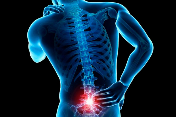 Fisioterapia para el Dolor Lumbar en El Cañaveral: Tratamiento y Recuperación Eficaz
