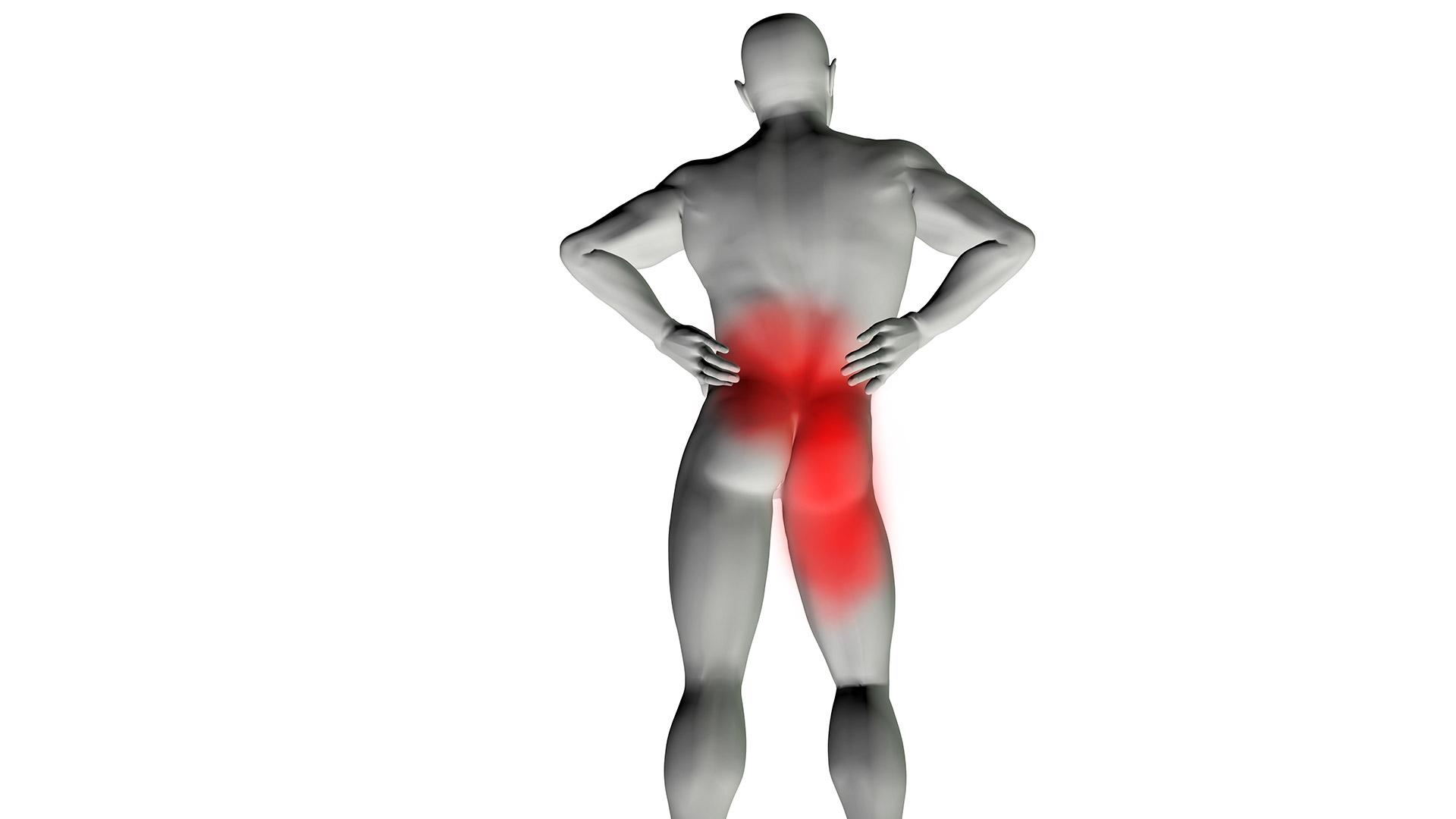 Ciática: síntomas, causas y cómo tratarla con fisioterapia y osteopatía